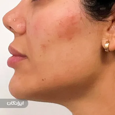 کلینیک زیبایی دکتر نازدانه بهمنی