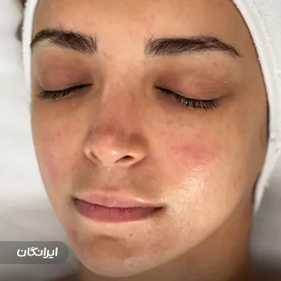 مرکز خدمات پوستی متینا