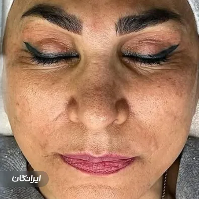 سالن مراقبت پوستی رها