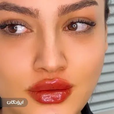 کلینیک زیبایی آوا