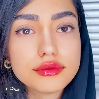 کلینیک زیبایی آوا