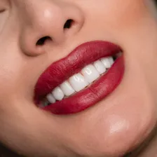 دندانپزشکی رویال