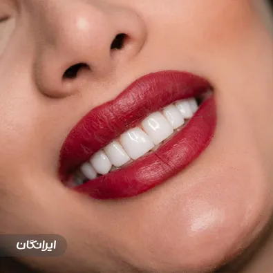 دندانپزشکی رویال