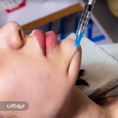 کلینیک زیبایی دلارز