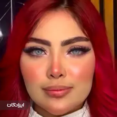 کلینیک زیبایی آنیل