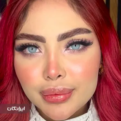 کلینیک زیبایی آنیل