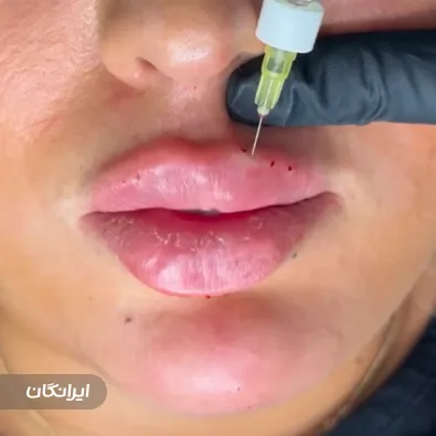 کلینیک زیبایی بهینا