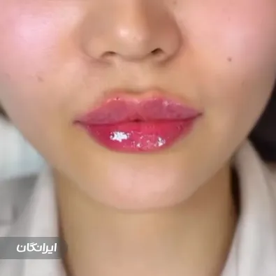 کلینیک زیبایی بهینا