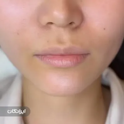 کلینیک زیبایی بهینا