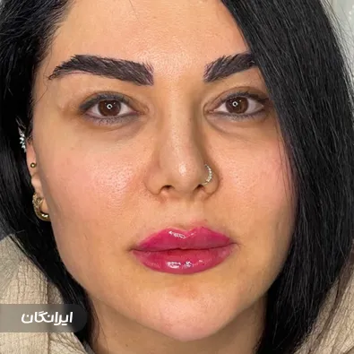 کلینیک زیبایی دکتر شایان اشرفی