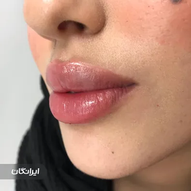 کلینیک زیبایی دکتر مهشید آقازاده