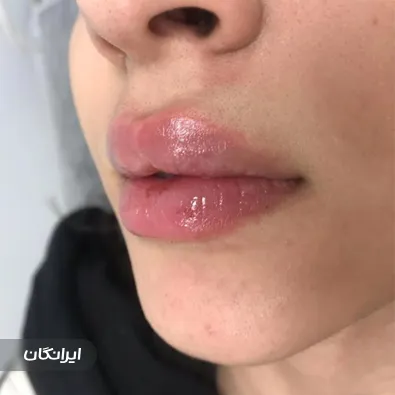 کلینیک زیبایی دکتر مهشید آقازاده