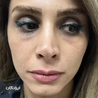 کلینیک زیبایی دکتر پرهام تبریزی