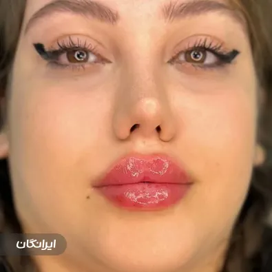 کلینیک زیبایی بلوط