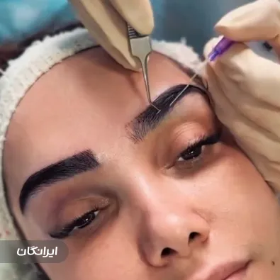 کلینیک کاشت مو باران