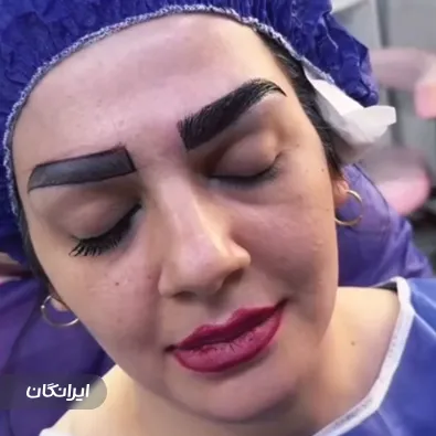 کلینیک کاشت مو باران