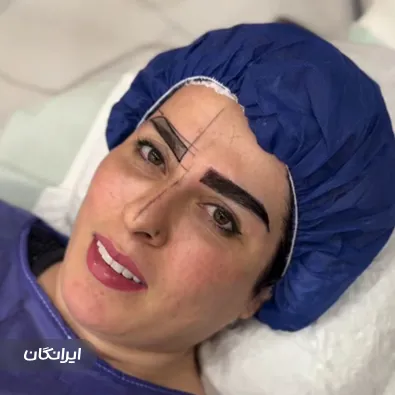 کلینیک کاشت مو باران