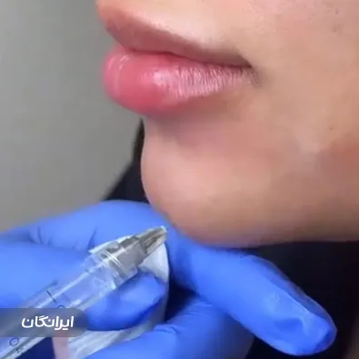 کلینیک زیبایی دلوان