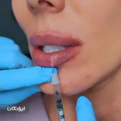 کلینیک زیبایی دلوان