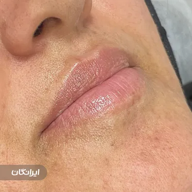 کلینیک زیبایی آی ناز