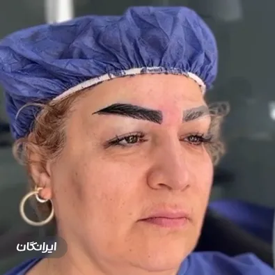 کلینیک کاشت موی مو ایران