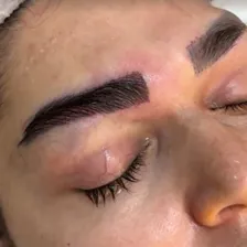 کلینیک کاشت موی مو ایران