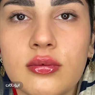 کلینیک زیبایی دکتر معصومه پورفرد