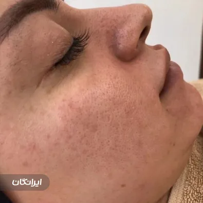 مرکز خدمات پوستی اف بیوتی