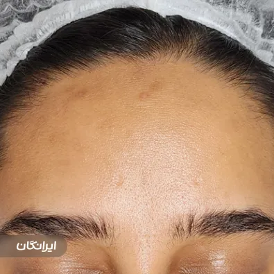 مرکز مراقبت پوستی رینا