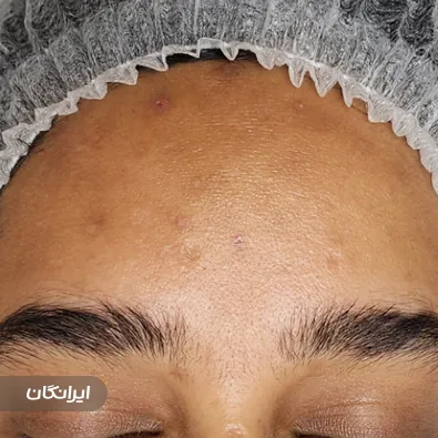 مرکز مراقبت پوستی رینا