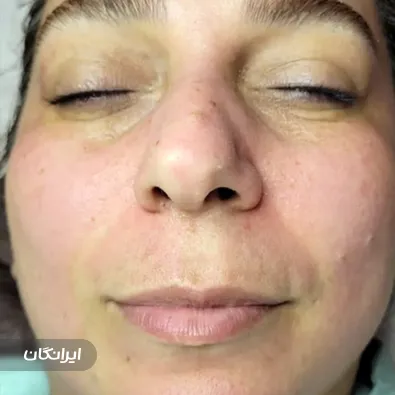 فیشیالیست فرشته رونق