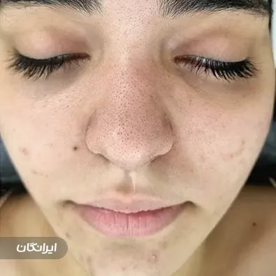 سالن مراقبت پوستی فرشته