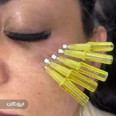 کلینیک زیبایی تاج