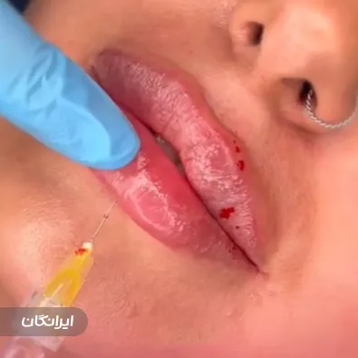 کلینیک زیبایی غزاله