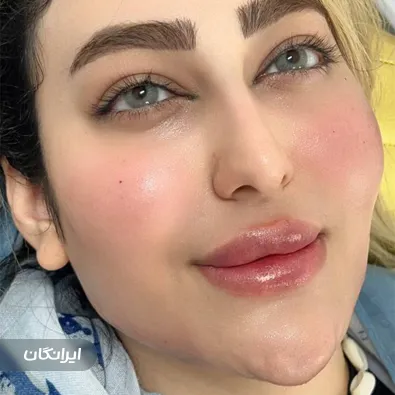 کلینیک زیبایی نیلان