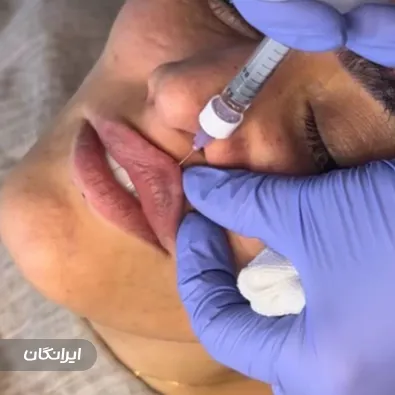 کلینیک زیبایی رز