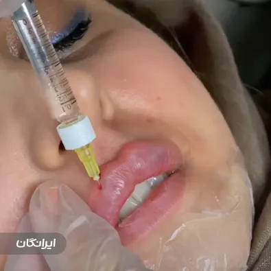 کلینیک زیبایی دکتر نیلوفر حسینی