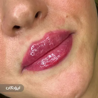 کلینیک زیبایی دکتر پریسا داوریار