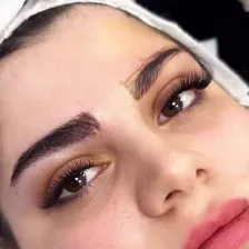 کلینیک کاشت مو رویش