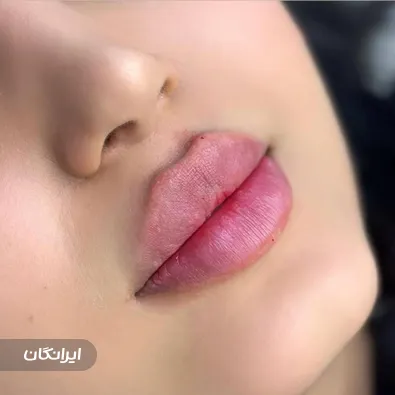 کلینیک زیبایی و لاغری باران