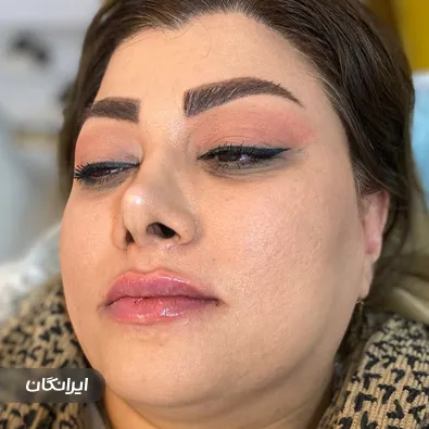 کلینیک زیبایی و لاغری باران