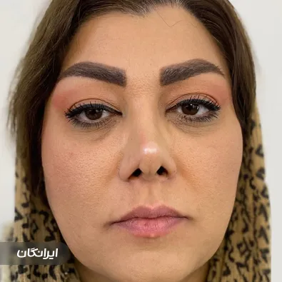 کلینیک زیبایی و لاغری باران