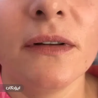 کلینیک زیبایی ابرون