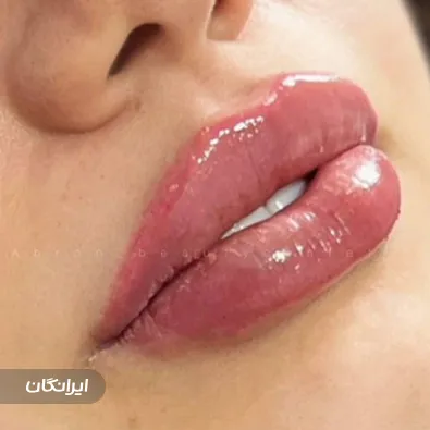 کلینیک زیبایی ابرون