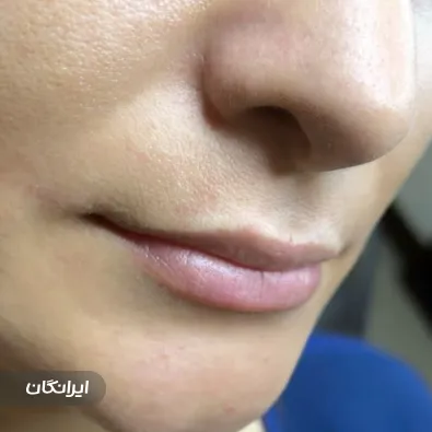 سالن آرایش دائم شعله مرادی