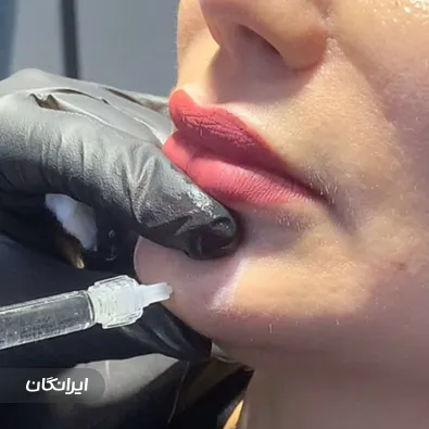 کلینیک زیبایی سوین