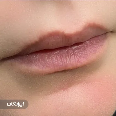 کلینیک زیبایی سوین