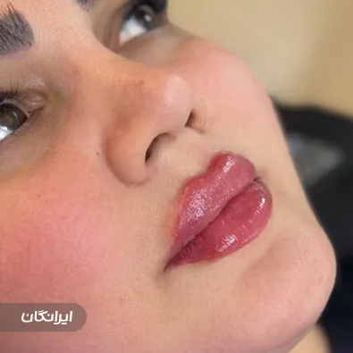 کلینیک زیبایی پاسارگاد