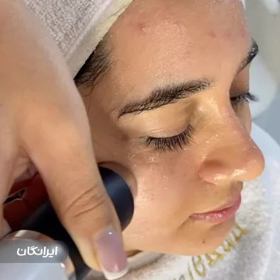 فیشیالیست مینا ملکان