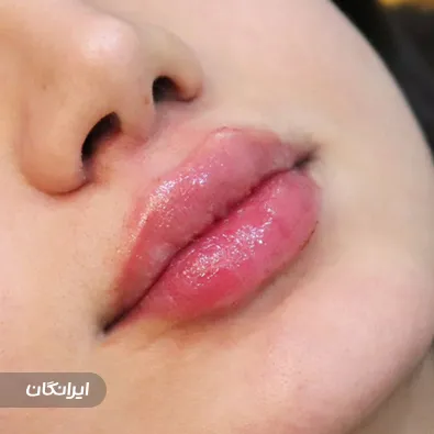 کلینیک زیبایی دکتر فریما قناعت